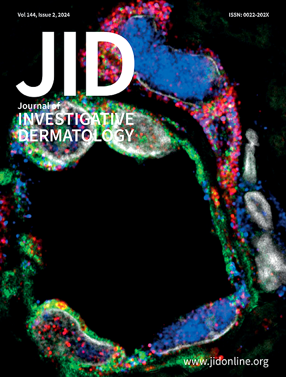 Go to journal home page - Journal of Investigative Dermatology